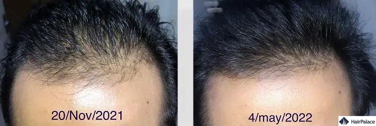 ist Rosmarinöl gut für die Haare